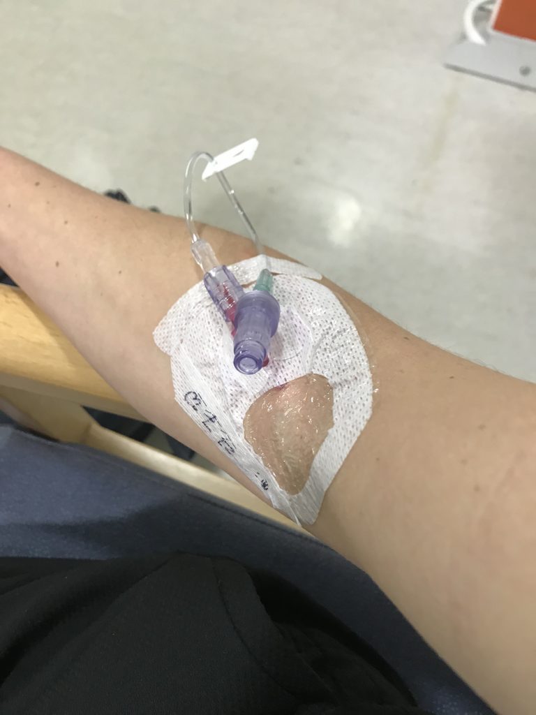 an arm with a intravenous line, in a medical setting